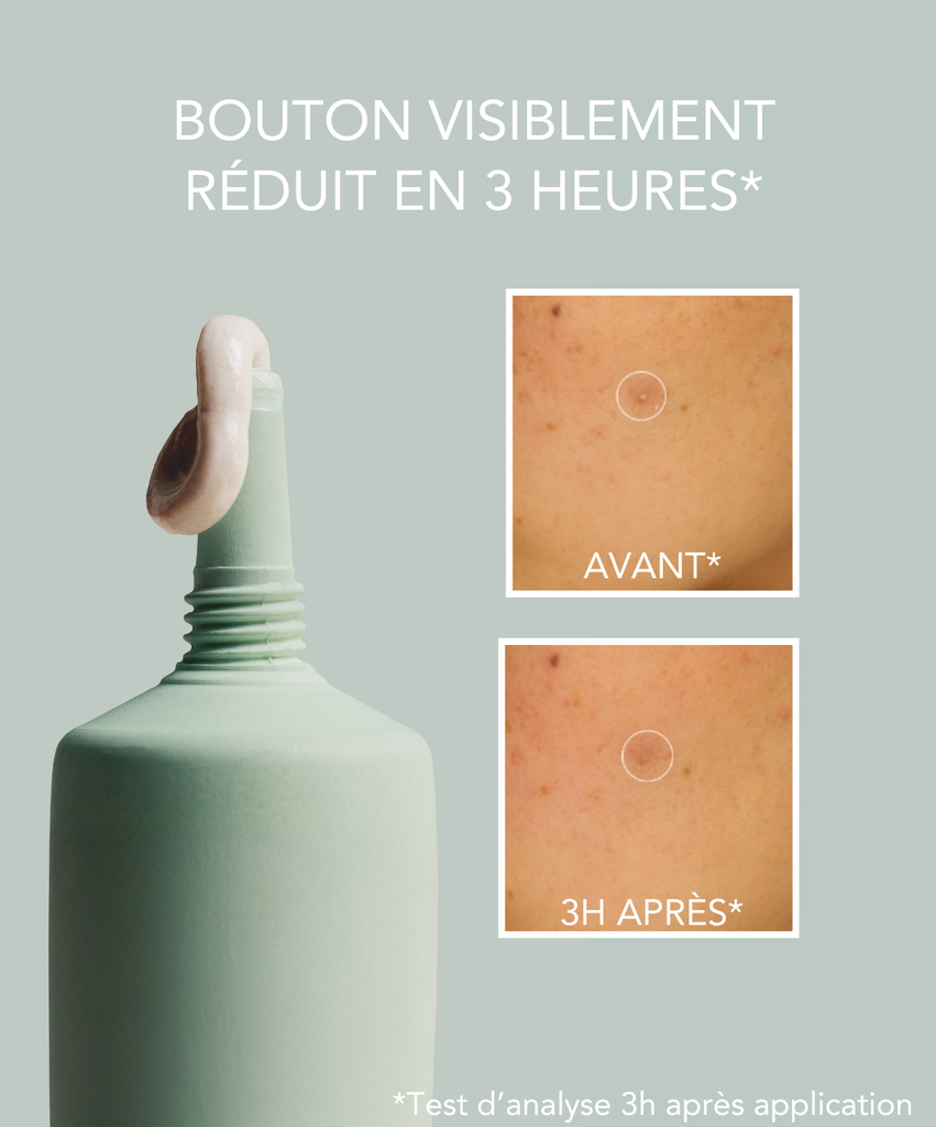 Pâte Stop-Boutons